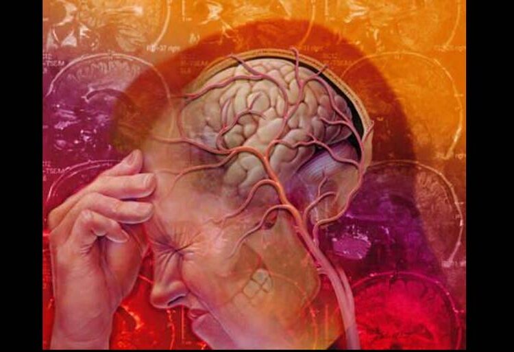 NEUROPATHIC Agony